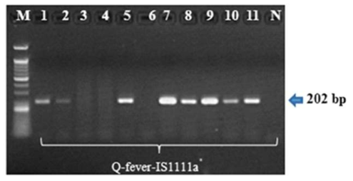 11명의 급성 큐열 간염 환자에서 포르말린에 고정된 간조직에서 PCR 시행 결과(8명에서 양성으로 확인됨)
