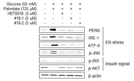당뇨 유도 지방간 오가노이드에서 #18-1 및 #18-2에 의한 ER stress 발현 인자 감소 및 insulin signal 회복