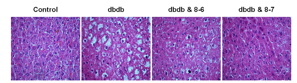 CYP4A 저해 유효물질 8번 유도체 Liver steatosis결과