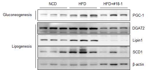 H gluconeogenesis 및 lipogenesis factor 발현 확인