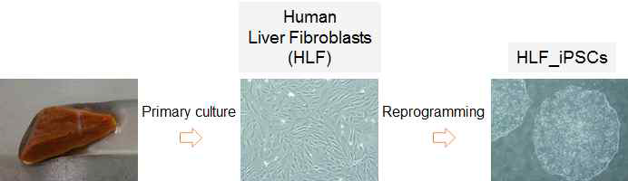간 조직으로부터 일차배양한 섬유아세포와 이로부터 제작된 iPSC 세포 이미지