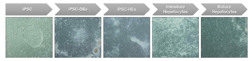 간조직유래 iPSC로부터 간세포로 분화 유도시 단계별 morphology 변화