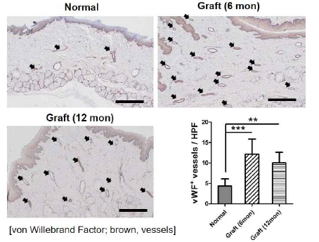 혈관 특이적 von Willebrand Factor (vWF) 면역염색을 통한 재생된 점막조직내 혈관의 분포도를 평가