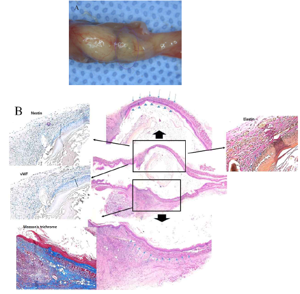 바이오리액터 배양된 인공식도 지지체의 전결손 모델에의 이식 (in vivo)