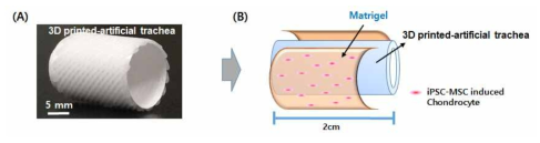 기관재생유도관 표면의 세포 도입법 고안. 3D 프린팅기법으로 제조된 인공 기관지지체(A)와 scaffold 표면의 세포도입법으로서 Matrigel® 에 iPS에서 분화된 연골세포를 담지 후 지지체 표면에 도포하는 방법(B)의 모식도