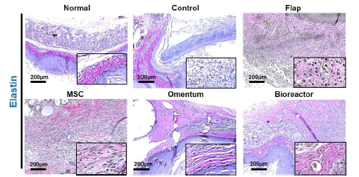 Elastin 특수염색을 통한 이식체 주변부의 elastin fiber의 비교분석