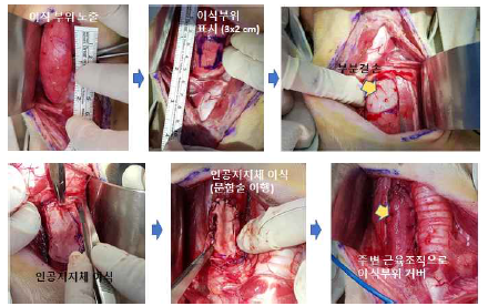 식도 부분결손 및 지지체의 이식과정