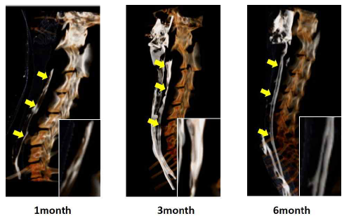 부분결손 이식된 비글 식도조직의 Micro-CT 영상분석