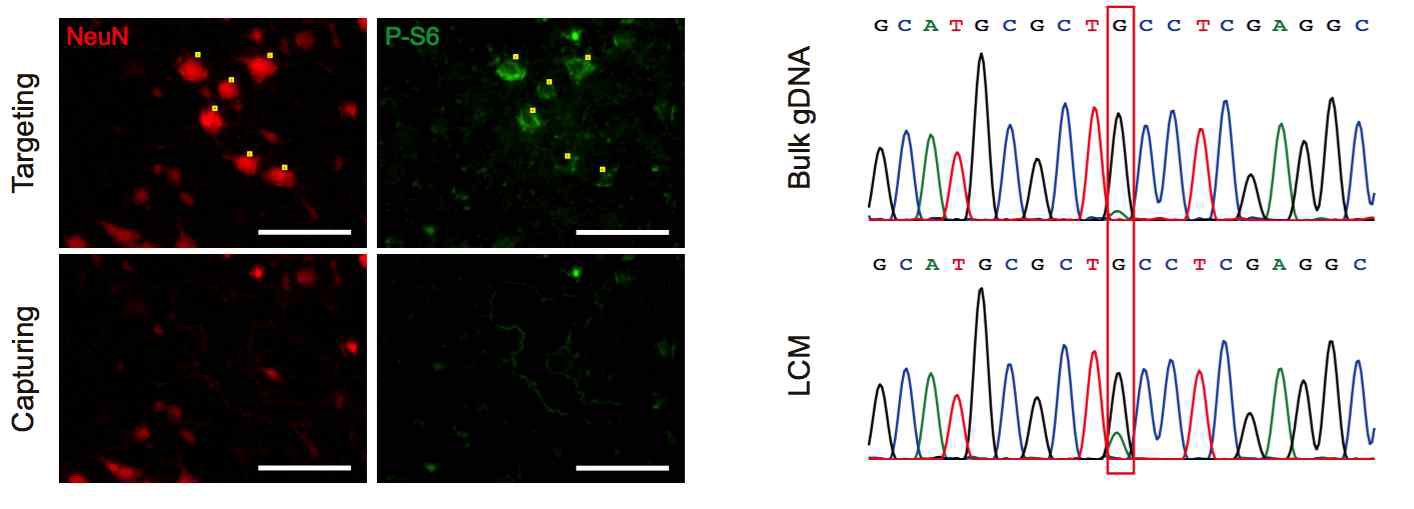 NeuN (neuronal marker), P-S6 (mTOR major readout) antibody를 이용하여 환자의 동결절편 조직에서 statining을 시행하였고 P-S6 postive cell 선택하여 laser capture 시행하였음. Capture 완료된 cell에서 genomic DNA를 추출하였고 Sanger sequecing을 시행하여 p.Cys1483Tyr mutation을 확인하였음