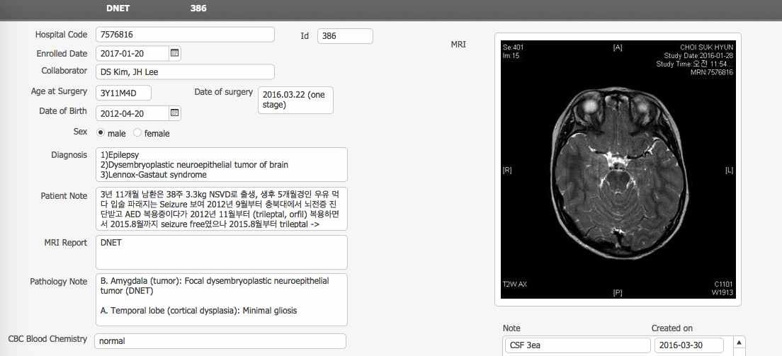 약물저항성 뇌전증 환자 코호트의 마지막 번호 환자 (DNET386)의 스크린샷