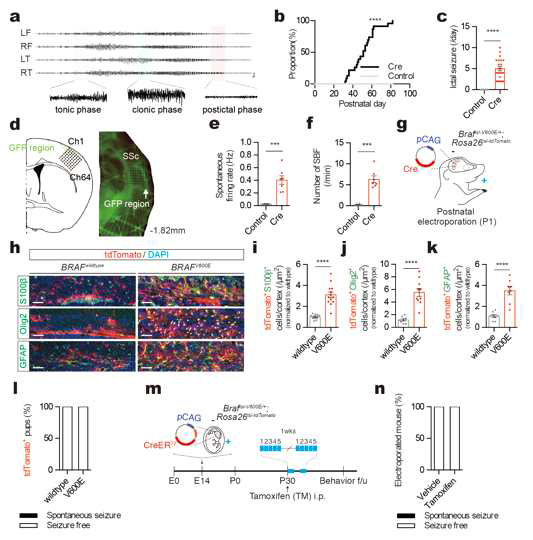 Developing brain의 neuronal progenitor cell에 BRAF V600E somatic mutation을 도입시 약물 저항성 뇌전증이 유발됨을 보이는 결과