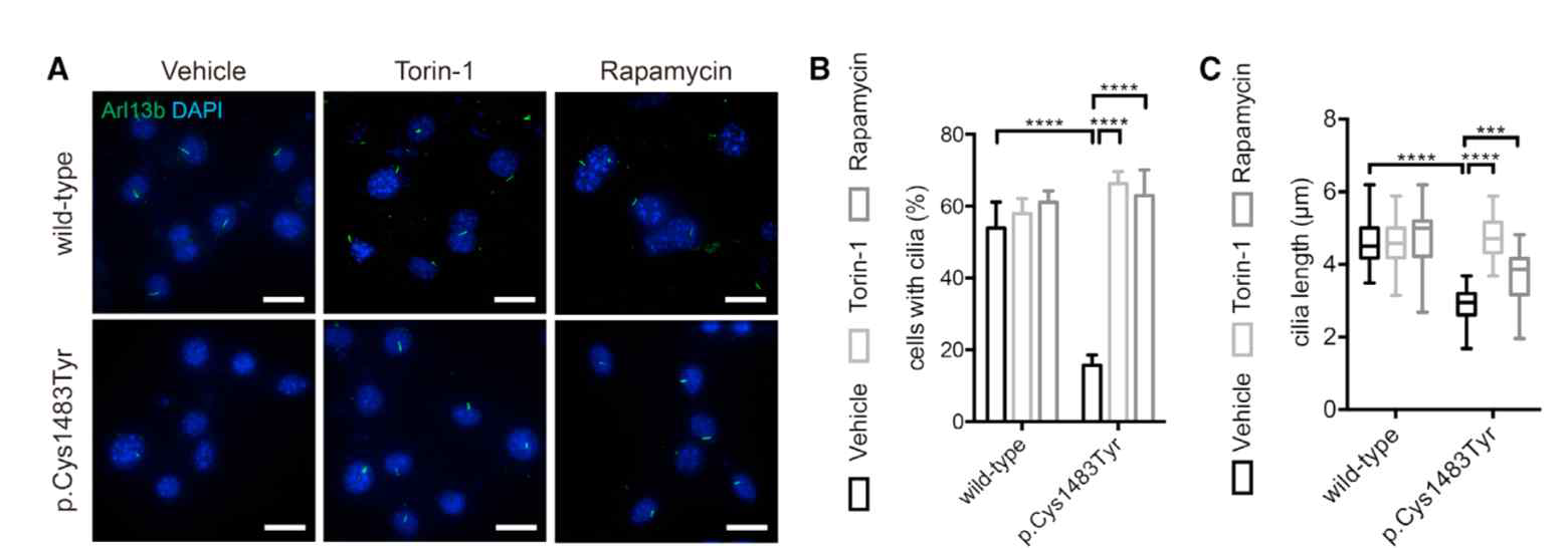 mTOR C1483Y NIH3T3 세포주에서 primary cilia 형성에 장애가 있으며 mTOR 활성 억제시 cilia가 다시 형성됨을 보여주는 결과