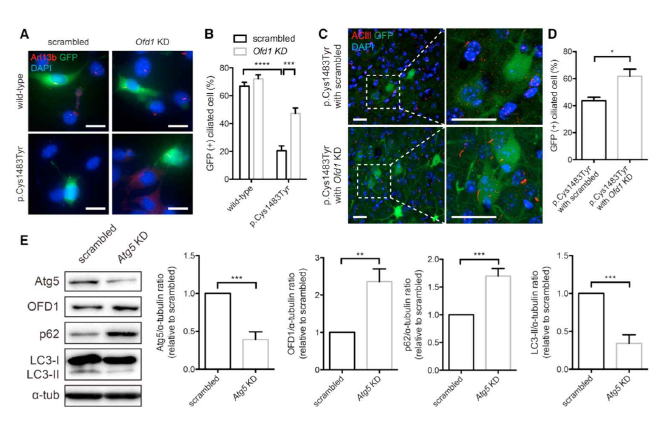 OFD1의 비정상적 축적이 primary cilia 형성 장애에 직접적인 원인임을 보여주는 in vitro & in vivo 결과