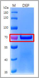 Desalting 후 68.7kDa의 항원단백의 발현을 SDS-PAGE로 확인 M: Marker, DEP: Desalting pooling