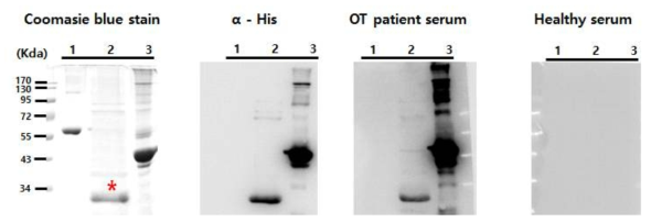 cTSA56 단백질을 대장균에서 발현, 정제하고 이를 anti-His antibody, 쯔쯔가무시병 환자 혈청, 그리고 정상인 혈청과 반응시켜 항원성을 확인하였음. (Lane 1: BSA, lane 2: cTSA56, lane 3: TSA56)