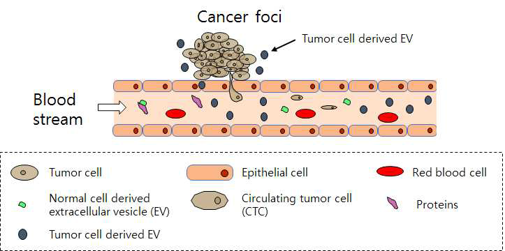 CTC와 세포 밖 소포체의 혈액으로의 유입