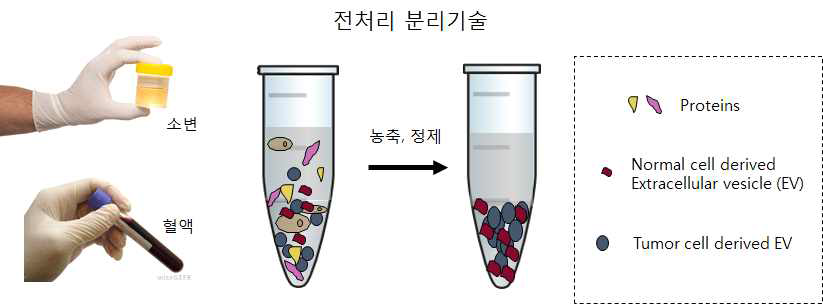 세포 밖 소포체의 전처리 분리 기술