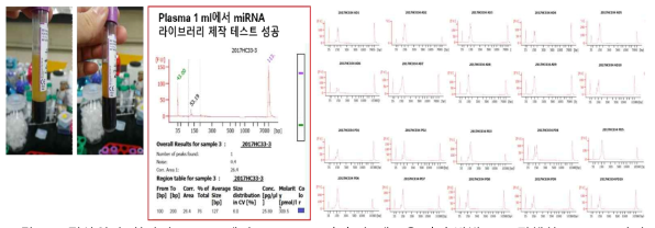 정상인과 환자의 plasma에서 miRNA 추출과 새로운 추출방법으로 진행한 miRNA 라이브러리 제작 예시