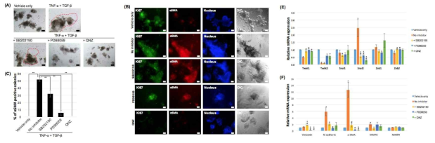 TNF-α와 TGF-β에 의한 장 오가노이드의 섬유아세포로의 변화 기전. (A) ERK, P38, NF-kB inhibitor로 처리한 후 섬유아세포 변화 여부에 대한 형태 관찰, (B) α-SMA, Ki67에 대한 면역형광 염색, (C) 이에 대한 정량화. (E) TNF-α 및 inhibitor 처리 후 섬유아세포 변화와 관련된 전사인자에 대한 발현 변화 및 (F) 섬유화관련 유전자 발현 변화