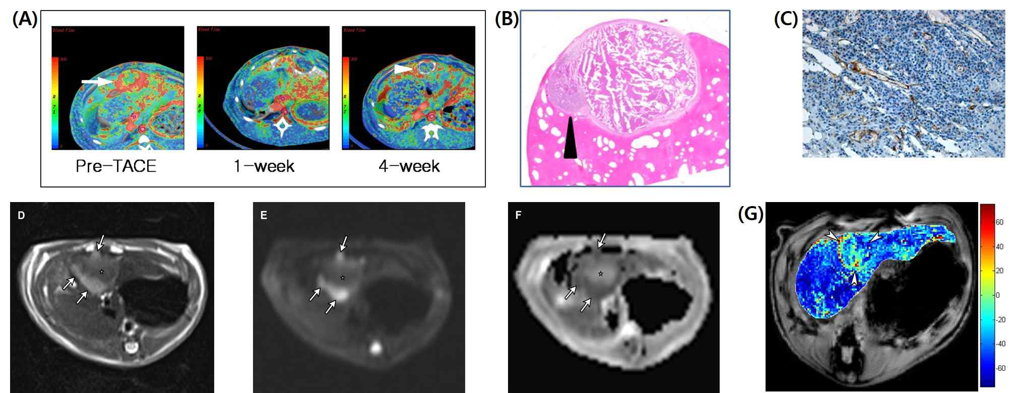 (A) 토끼 간암 모델에서 dynamic contrast-enhanced perfusion CT 기법을 이용해 화학색전술 후 종양의 조기 angiogenesis 와 재발을 진단함. (B) H&E 염색기법으로 관류 CT 영상에서 진단한 재발부위를 확진함. (C) CD34 염색으로 관류 CT 영상에서 예측한 angiogenesis를 확인함. (D) 쥐 (rat) 간암 모델에서 화학색전술 후 MRI 영상으로 종양의 재발을 진단. (E) 확산 강조 영상으로 종양 재발부위의 세포밀집도가 높음을 확인. (F) Apparent diffusion coefficient map을 얻어 종양 확산강조 영상 소견을 정량화. (G) blood-oxygen level dependent (BOLD) MRI 기법을 이용해 화학색전술 전후의 관류 상태 변화를 평가