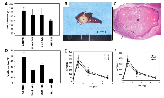 쥐 (rat) 간암 모델에서 HIF-1α inhibitor-PLGA 미세구를 이용한 화학색전술과 기존화학색전술 방식의 (A) 종양크기 변화, (B) 육안병리 소견, (C) H&E 염색 소견, (D) 종양의 괴사 정도, 그리고 (E)(F) 간독성 비교 평가