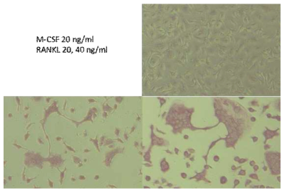 Mouse의 Bone Marrow derived monocytes를 분리하여 M-CSF와 RANKL을 처리하였음. osteoclast로의 분화를 확인하였음