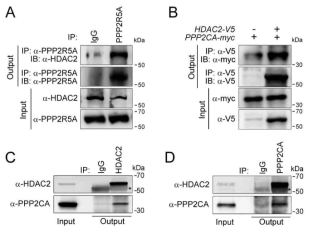 HDAC2는 Phosphatase인 PP2A와 결합함