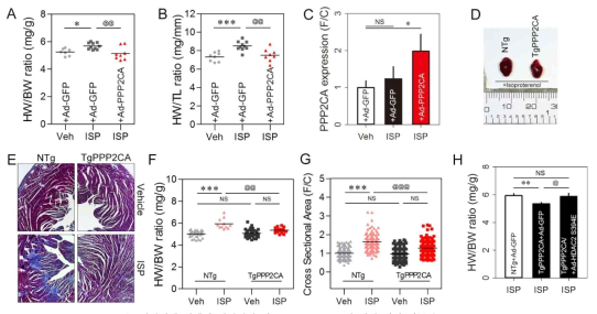 PPP2CA Transgenic mice는 심장비대 발생이 억제되어 있고, HDAC2 S394E에 의해 다시 회복됨