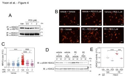 Pharmacologic intervention with HSP70 blocks PE-induced enlargement of NRVCs by inhibition of HDAC2 phosphorylation and activation