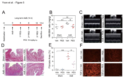 Pharmacologic intervention with HSP70 blocks cardiac hypertrophy in vivo animal model