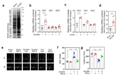 Aberrant activation of neuronal nitric oxide synthase (NOS) in the heart accelerates heart failure with preserved ejection fraction (HFpEF)