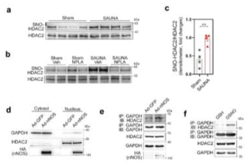 HFpEF stresses S-nitrosylase HDAC2, which was mediated by redistribution of the cytoplasmic Gapdh into the nucleus