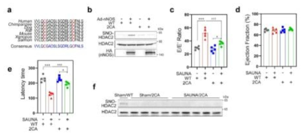 HDAC2 S-nitrosylation undergoes C262 and C274, which exacerbates HFpEF