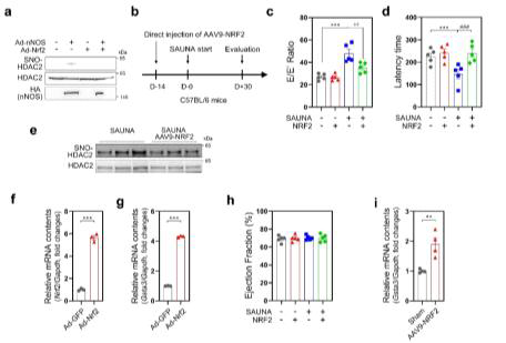 HDAC2 S-nitrosylation undergoes C262 and C274, which exacerbates HFpEF