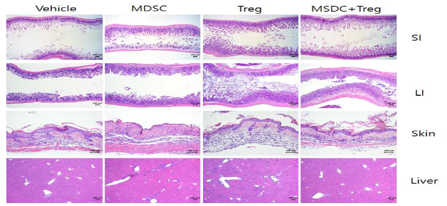 MDSC, Treg 세포의 병용투여에 의한 타킷조직손상 억제효능(1차 실험결과)