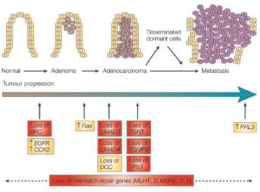 대장암의 다단계 진행 단계 (Nature review, 2005)