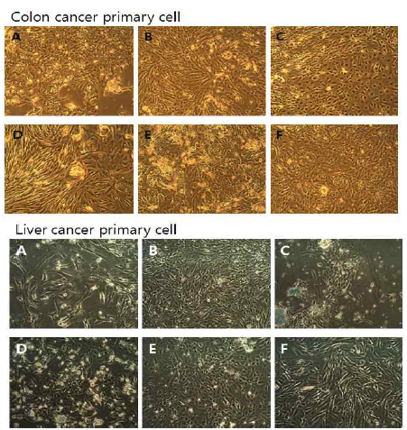 대장암, 간암 일차암세포주