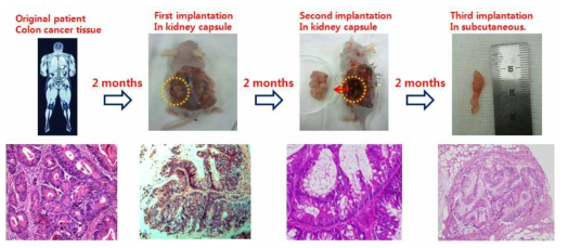 환자 대장암 조직을 이용한 이종동물모델 제작