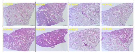 Bleomycin 으로 유도한 폐섬유화 마우스 모델에서의 염증반응 확인