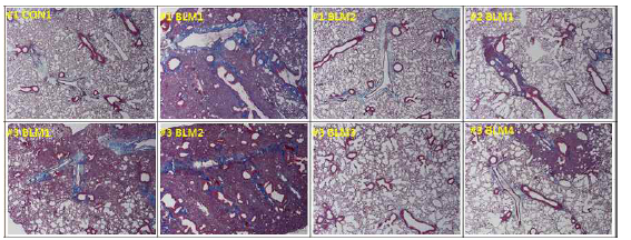 Bleomycin 으로 유도한 폐섬유화 마우스 모델에서의 collagen deposition 확인