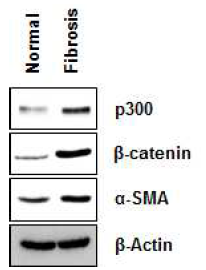 폐섬유화 환자유래 fibroblast에서 p300의 발현 확인