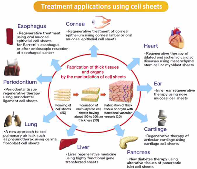 세포시트 응용한 재생 의학적 기능복원 대상 장기들