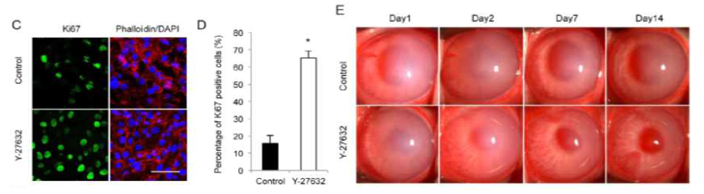 Y27632 처리 시 토끼의 각막내피세포 증식 및 투명도 향상(참고문헌)