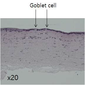 LSCD 모델에서 벗겨낸 pannus 조직