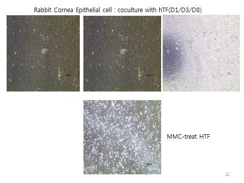 각막 상피세포의 fibroblast 공배양시 세포 형태