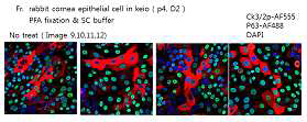 각막 상피세포의 형광면역염색 결과. a-CK3/2p(빨강), a-P63(초록)