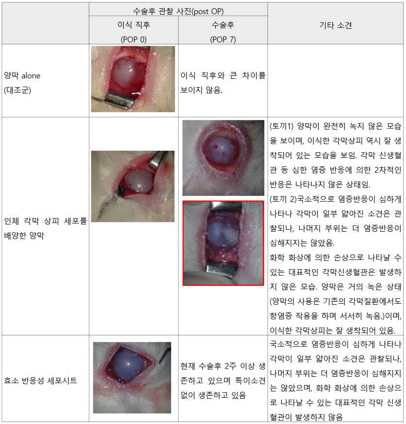 양막 및 각막 세포시트 이식 결과