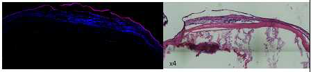 실험군 3의 면역형광 염색: human mitochondria