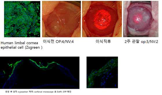 Zs-green 이 표지된 세포시트 이식 후 시트 존재 확인