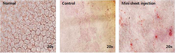 Mini sheet injection 후 14일 째 안락사 시킨 후 안구를 적출하여 0.2% Alizalin Red 로 내피세포를 염색한 결과 내피세포의 morphology와 density는 control보다 많이 향상되었음